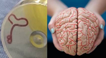 Escalofriante descubrimiento: identifican primer gusano parásito en cerebro humano