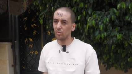 El periodista palestino Mahmoud Zakarneh, con el número 44 en su frente.