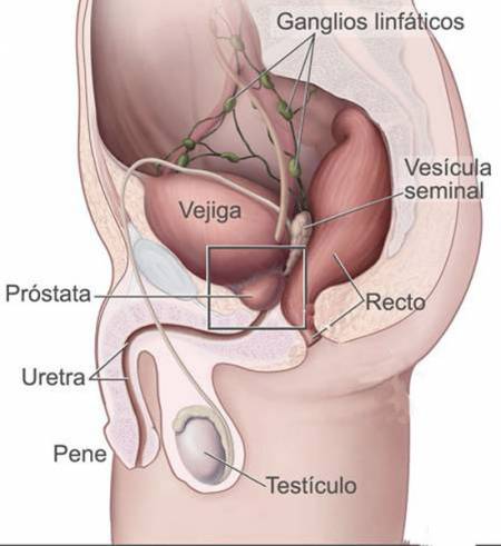 Localización de la próstata