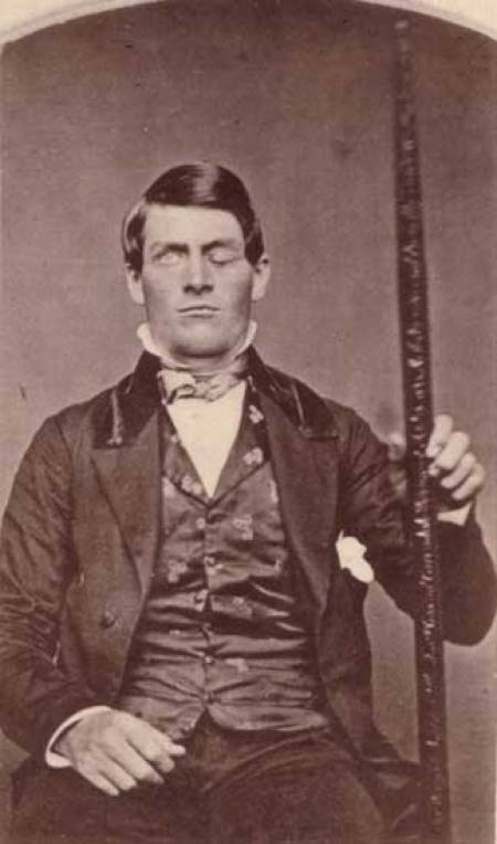 Phineas Gage