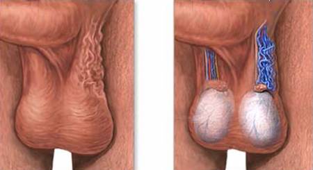 Calzoncillos varicocele best sale
