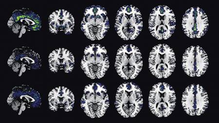 Evolución cerebral 
