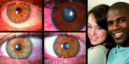 El color de ojos