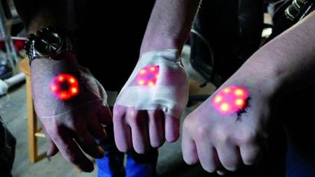 Implantes con luces LED