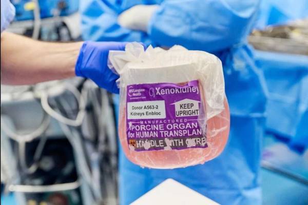 Xenotransplantación