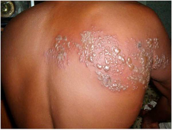 Un virus nada simple en sus consecuencias - Juventud Rebelde - Diario de la juventud cubana Un virus nada simple en sus consecuencias - Juventud Rebelde - Diario de la juventud cubana